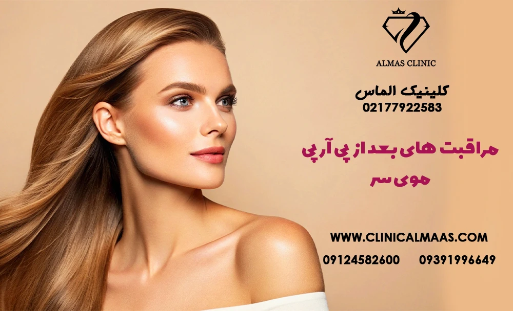 مراقبت‌های بعد از پی‌آرپی موی سر